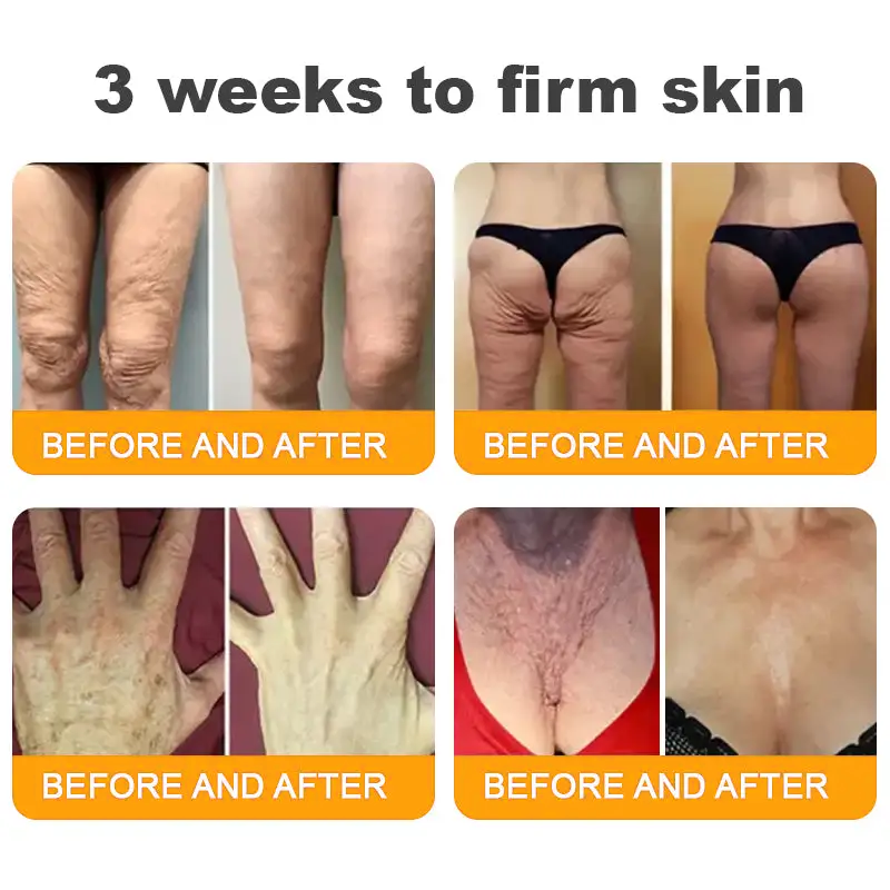 Made and Shipped from USA ✨ TLOPA® Bee Venom Skin Restoration Cream ⏰ LAST DAY 80% OFF💥💥