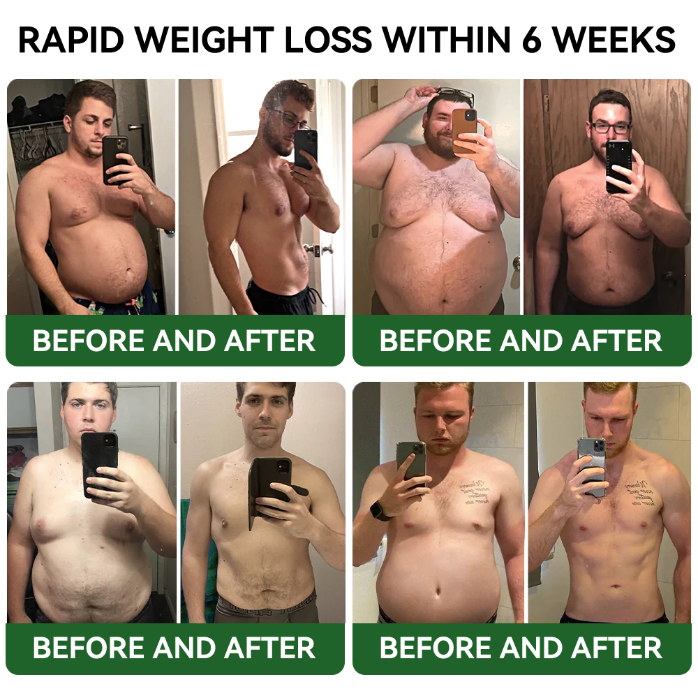 𝐓𝐋𝐎𝐏𝐀® 𝐆𝐋𝐏-𝟏 𝐒𝐥𝐢𝐦𝐦𝐢𝐧𝐠 & 𝐇𝐞𝐚𝐥𝐭𝐡 𝐁𝐨𝐨𝐬𝐭 𝐃𝐫𝐨𝐩𝐬 (𝐅𝐨𝐨𝐝-𝐠𝐫𝐚𝐝𝐞 𝐅𝐚𝐭 𝐁𝐮𝐫𝐧𝐞𝐫)🔥