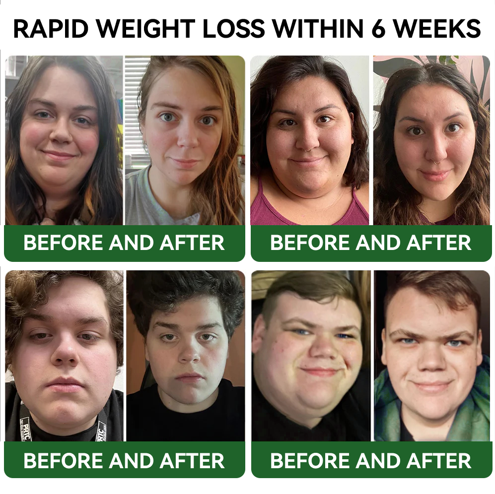 𝐓𝐋𝐎𝐏𝐀® 𝐆𝐋𝐏-𝟏 𝐒𝐥𝐢𝐦𝐦𝐢𝐧𝐠 & 𝐇𝐞𝐚𝐥𝐭𝐡 𝐁𝐨𝐨𝐬𝐭 𝐃𝐫𝐨𝐩𝐬 (𝐅𝐨𝐨𝐝-𝐠𝐫𝐚𝐝𝐞 𝐅𝐚𝐭 𝐁𝐮𝐫𝐧𝐞𝐫)🔥