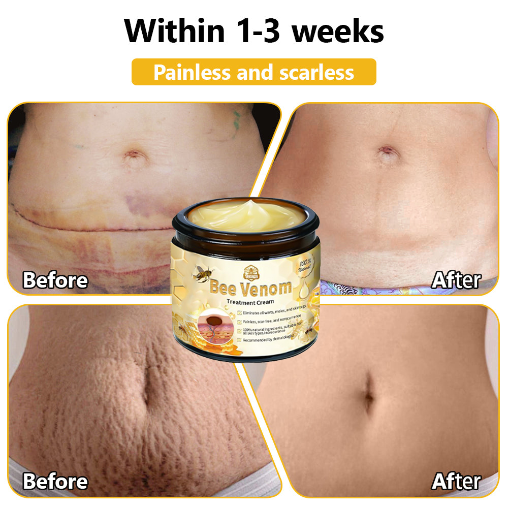 ๐ง๐๐ข๐ฃ๐ยฎ Bee Venom Skin Treatment Cream (FDA Approved๐จโโ๏ธ)๐