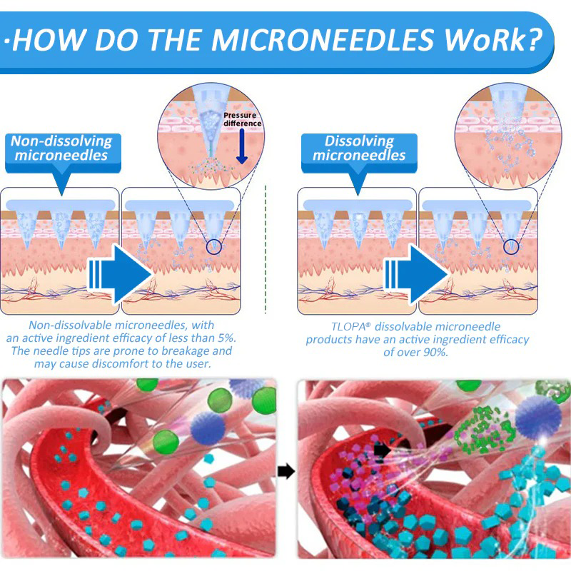 TLOPA® Nano Microneedle Patch with SMGT-GLP-1 & Matrixyl 3000 – Slimming,👨⚕️ Skin Tightening, Blood Sugar Support, No Injection, 7-Day Result