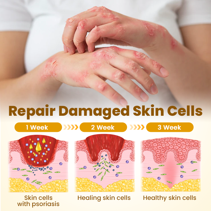 Made and Shipped from USA ✨ 𝗧𝗟𝗢𝗣𝗔® Bee Venom Skin Restoration Cream ⏰