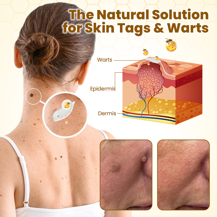 Made and Shipped from USA ✨ 𝗧𝗟𝗢𝗣𝗔® Bee Venom Skin Restoration Cream ⏰