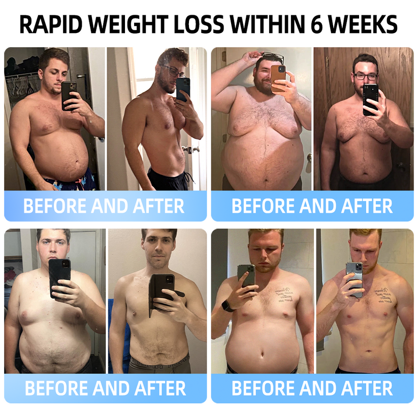 [See results in 7 days🔥]🇺🇸Croaie® SMGT-GLP-1 Nano Microneedle Patch（Painless, long-lasting, addressing diabetes, obesity, and cardiovascular diseases)