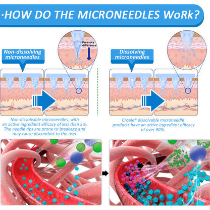 [See results in 7 days🔥]🇺🇸Croaie® SMGT-GLP-1 Nano Microneedle Patch（Painless, long-lasting, addressing diabetes, obesity, and cardiovascular diseases)