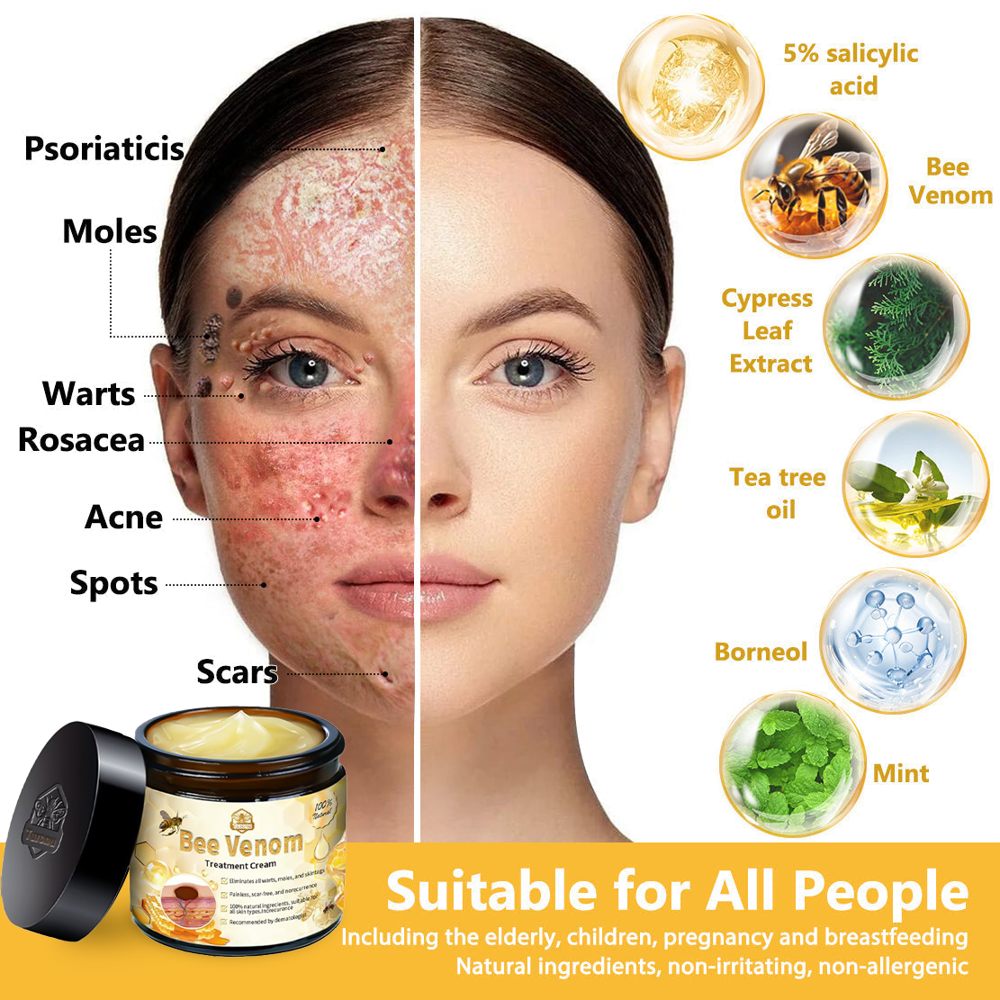 𝗧𝗟𝗢𝗣𝗔® Bee Venom Skin Treatment Cream (FDA Approved👨‍⚕️)💖