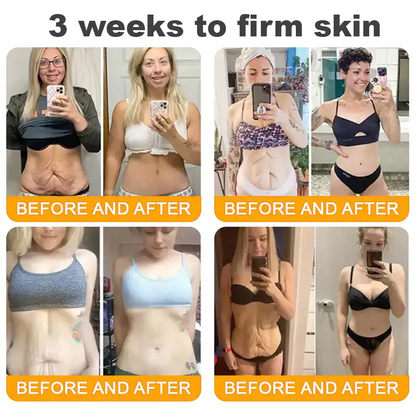 Made and Shipped from USA ✨ TLOPA® Bee Venom Skin Restoration Cream ⏰ LAST DAY 80% OFF🍓