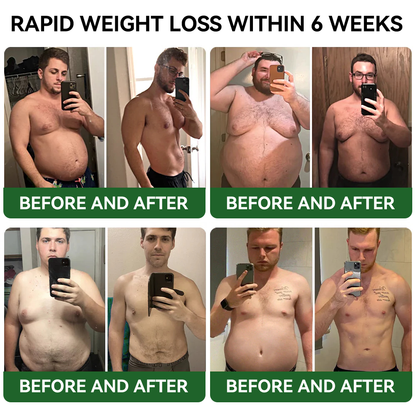 𝐓𝐋𝐎𝐏𝐀® 𝐆𝐋𝐏-𝟏 𝐒𝐥𝐢𝐦𝐦𝐢𝐧𝐠 & 𝐇𝐞𝐚𝐥𝐭𝐡 𝐁𝐨𝐨𝐬𝐭 𝐃𝐫𝐨𝐩𝐬 (𝐅𝐨𝐨𝐝-𝐠𝐫𝐚𝐝𝐞 𝐅𝐚𝐭 𝐁𝐮𝐫𝐧𝐞𝐫)🔥