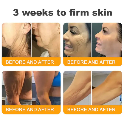 Made and Shipped from USA ✨ TLOPA® Bee Venom Skin Restoration Cream ⏰ LAST DAY 80% OFF🍓