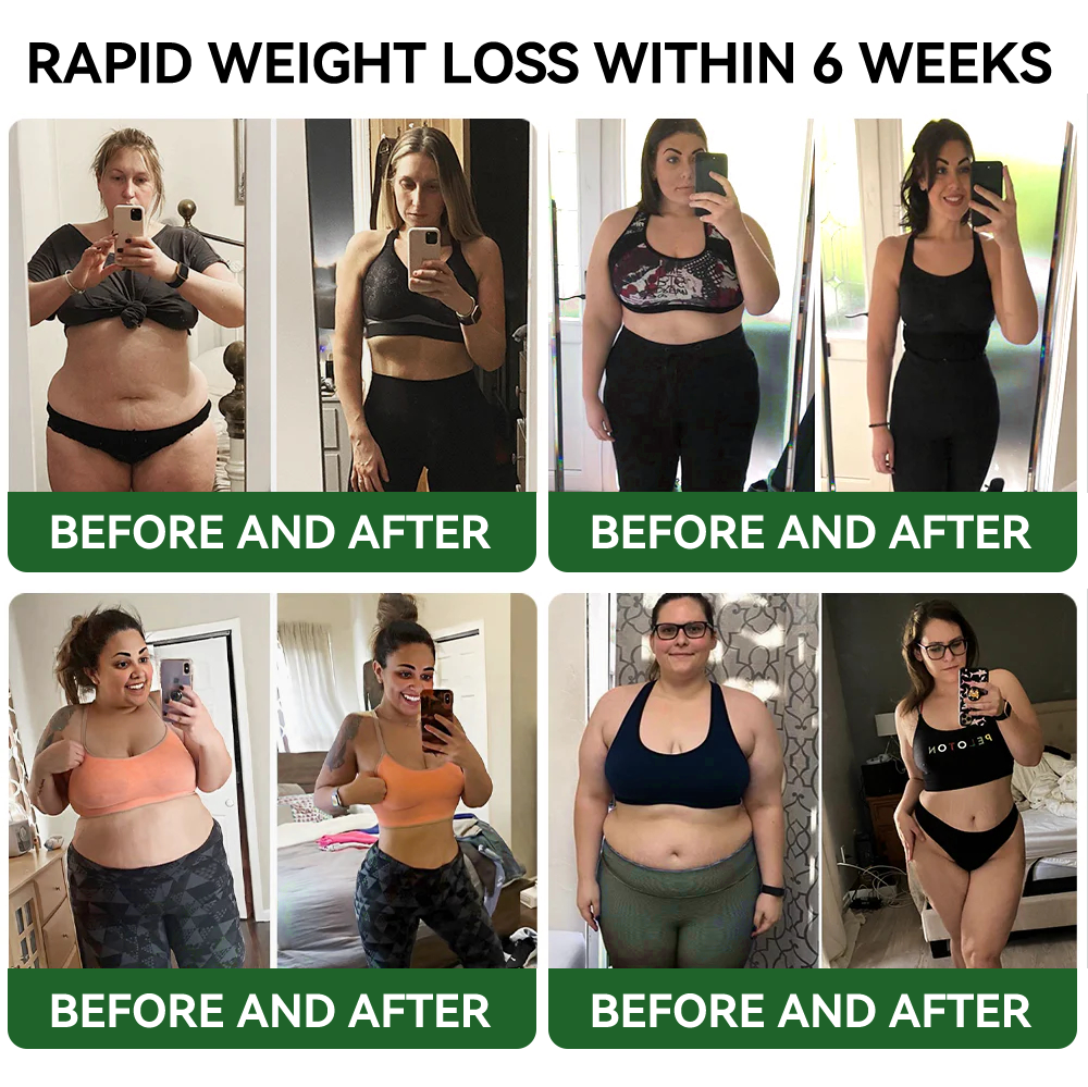 𝐓𝐋𝐎𝐏𝐀® 𝐆𝐋𝐏-𝟏 𝐒𝐥𝐢𝐦𝐦𝐢𝐧𝐠 & 𝐇𝐞𝐚𝐥𝐭𝐡 𝐁𝐨𝐨𝐬𝐭 𝐃𝐫𝐨𝐩𝐬 (𝐅𝐨𝐨𝐝-𝐠𝐫𝐚𝐝𝐞 𝐅𝐚𝐭 𝐁𝐮𝐫𝐧𝐞𝐫)🔥