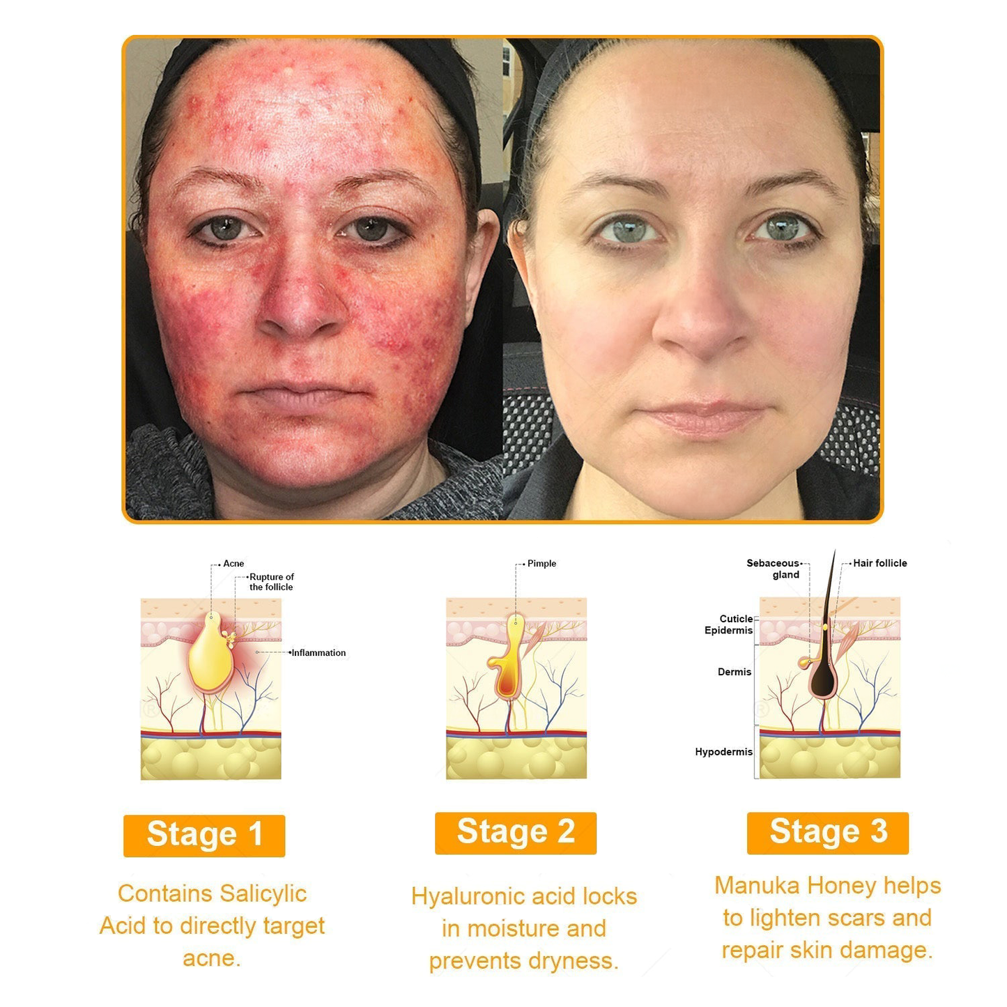 TLOPA®  7-Day Multi-Effect All-in-One Skincare Cream (FDA Approved👨‍⚕️)💖