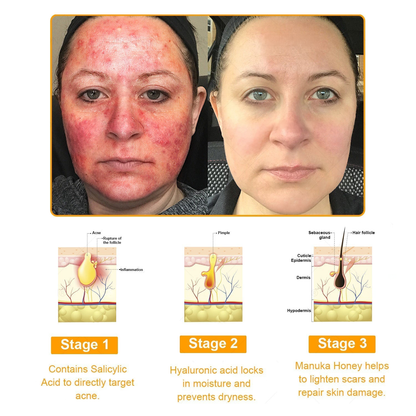 TLOPA®  7-Day Multi-Effect All-in-One Skincare Cream (FDA Approved👨‍⚕️)💖