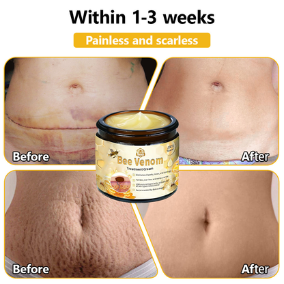 𝗧𝗟𝗢𝗣𝗔® Bee Venom Skin Treatment Cream (FDA Approved👨‍⚕️)💖