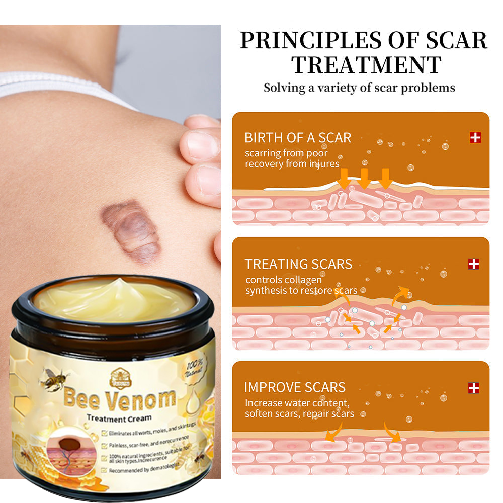 𝗧𝗟𝗢𝗣𝗔® Bee Venom Skin Treatment Cream (FDA Approved👨‍⚕️)💖