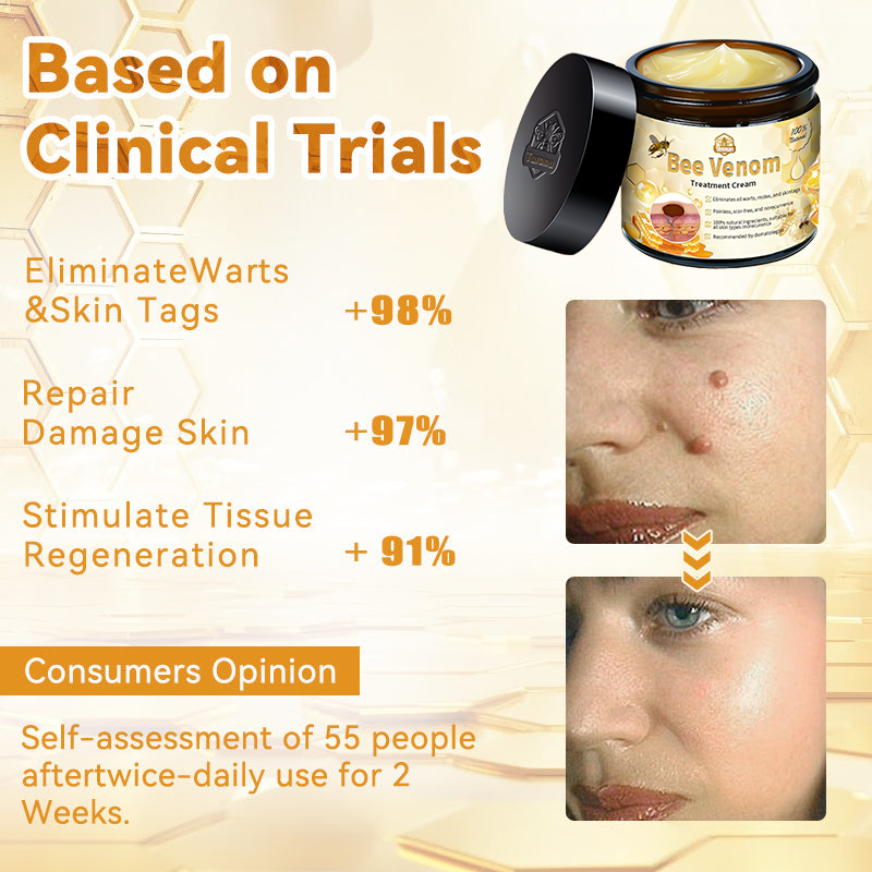 𝗧𝗟𝗢𝗣𝗔® Bee Venom Skin Treatment Cream (FDA Approved👨‍⚕️)💖