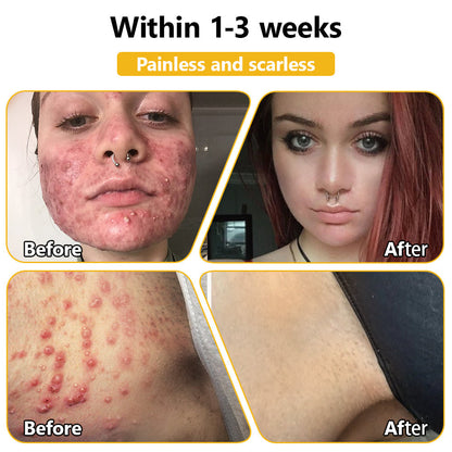 𝗧𝗟𝗢𝗣𝗔® Bee Venom Skin Treatment Cream (FDA Approved👨‍⚕️)💖