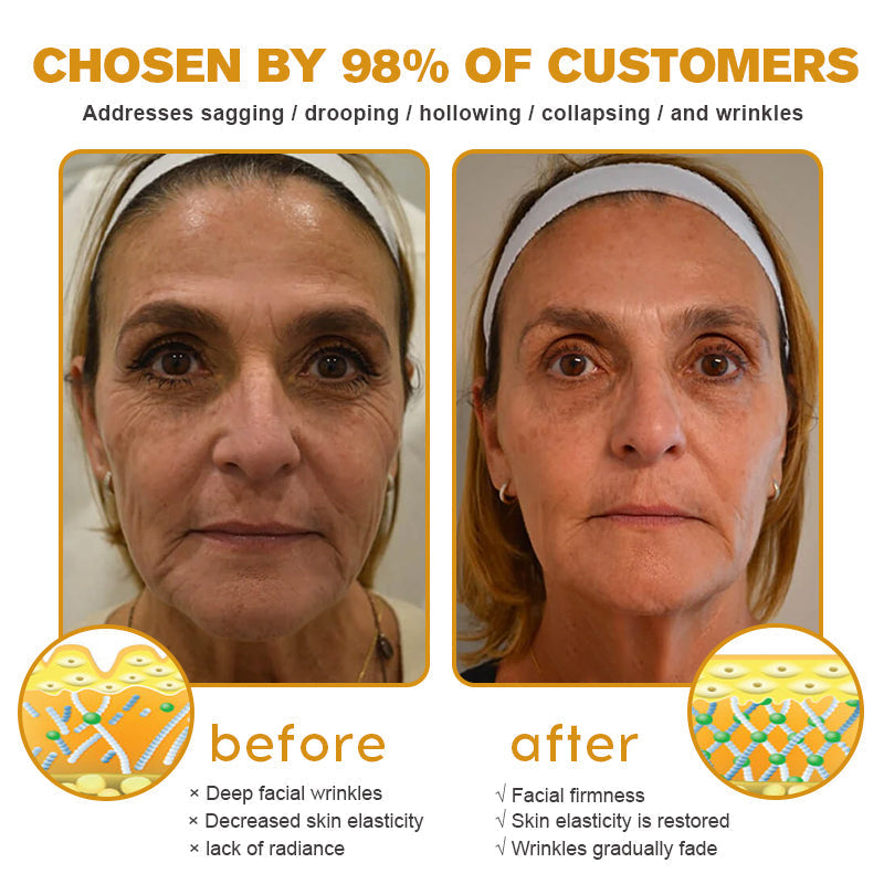 👨‍⚕️ Made and Shipped from USA✅ TLOPA® Botox Bee Venom Wrinkle Removal Cream- LAST DAY 80% OFF