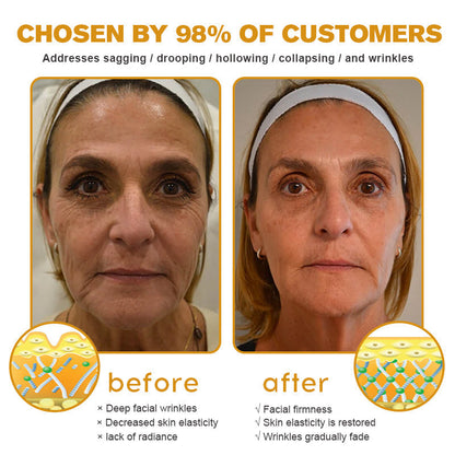 👨‍⚕️ Made and Shipped from USA✅ TLOPA® Botox Bee Venom Wrinkle Removal Cream- LAST DAY 80% OFF